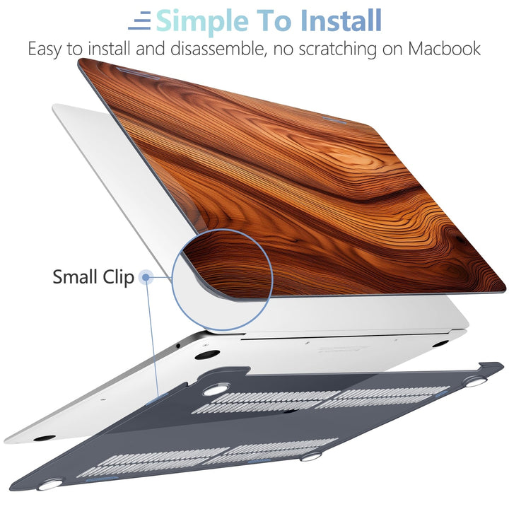 Cherry Blossom MacBook Air 13 Case & Accessories