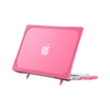 Batianda Pink 14 MacBook Pro Case
