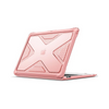 Rose Gold MacBook Air Case